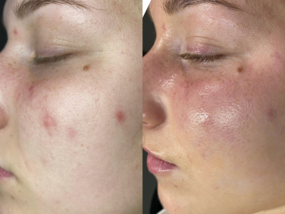 Screenshot 2025-03-05 at 2.37.21 PM